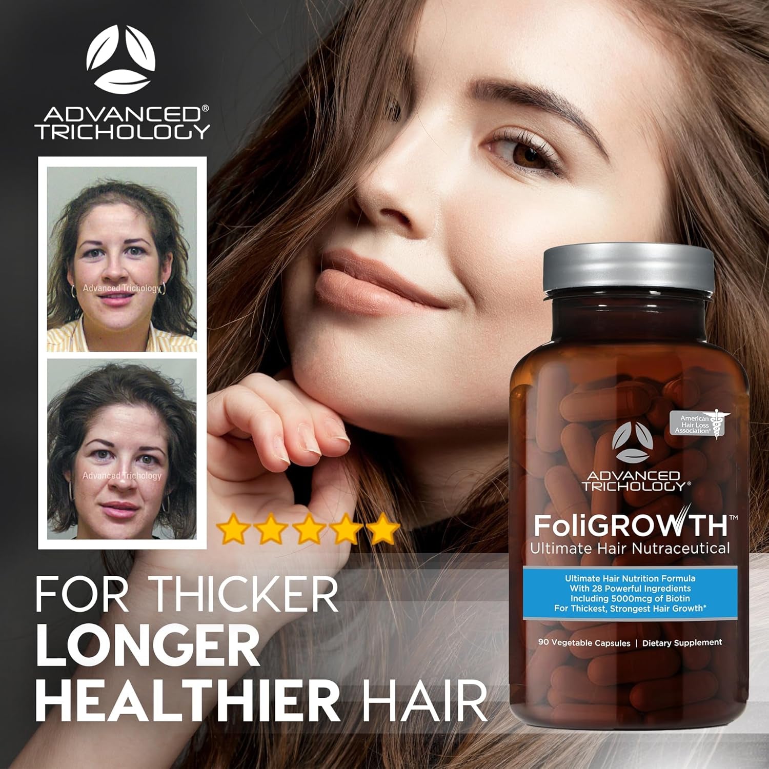 Foligrowth™ Hair Growth Supplement for Thicker Fuller Hair | Approved* by the American Hair Loss Association | Revitalize Thinning Hair, Backed by 20 Years of Experience in Hair Loss Treatment Clinics