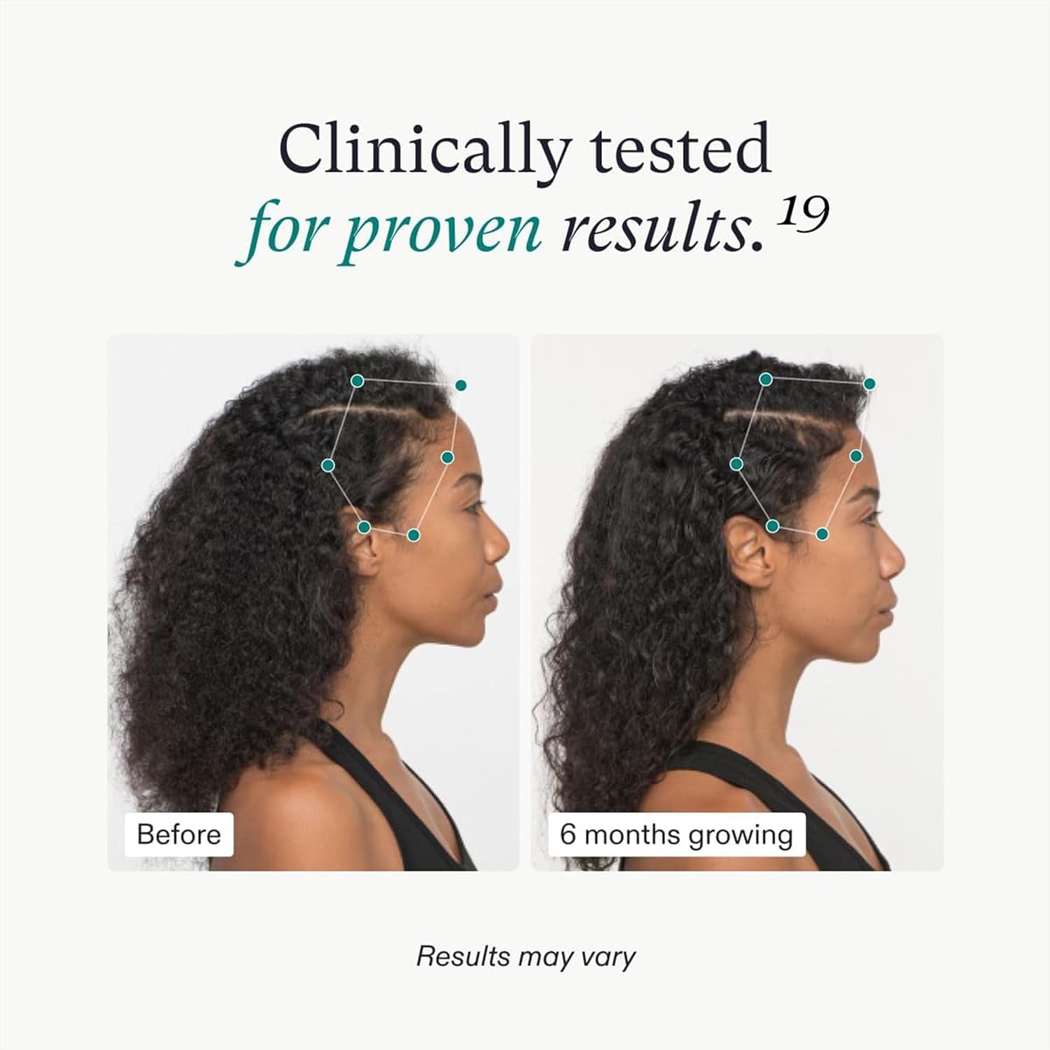 Nutrafol  Women'S Hair Growth Supplements, for Women 18-44 Years Old, Clinically Tested for Visibly Thicker, Stronger Hair, 100% Vegan Ingredients, Dermatologist Recommended - 1 Month Supply